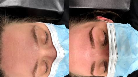velashape spruce grove|Lash & Makeup Lounge.